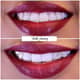 Slider image (7) FMS Dental Hospital - Kukatpally